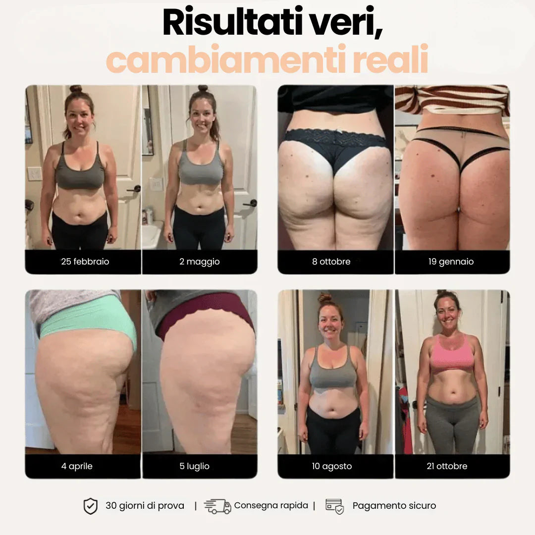 Leggings mit 3D-Anti-Cellulite-Effekt