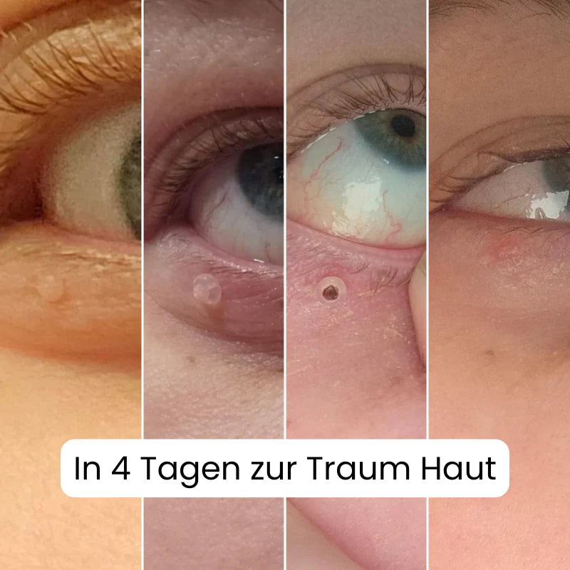 TagBuddy Kit – Mehr Hautanhängsel mehr